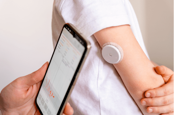 I Wore a Glucose Monitor for a Month—Here’s What Surprised Me